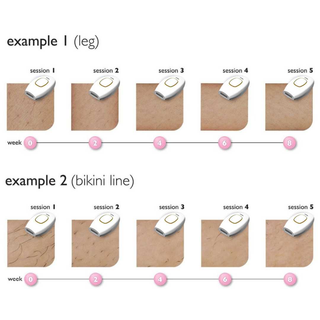 Femboy IPL Hair Removal Device